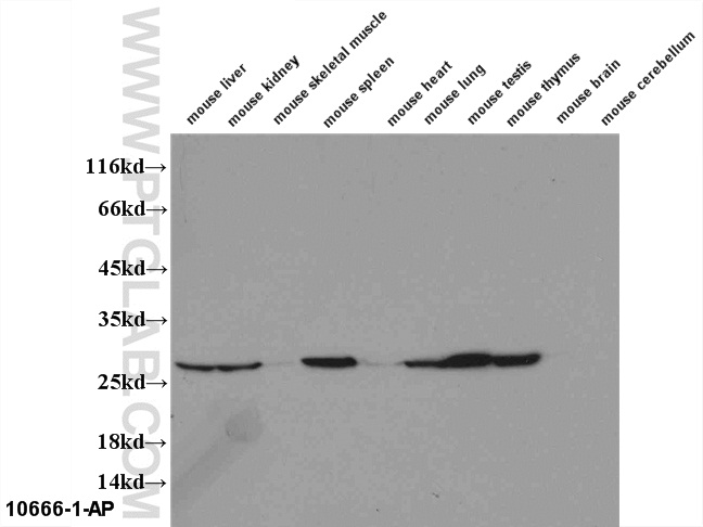 WB analysis of multi-tissue using 10666-1-AP