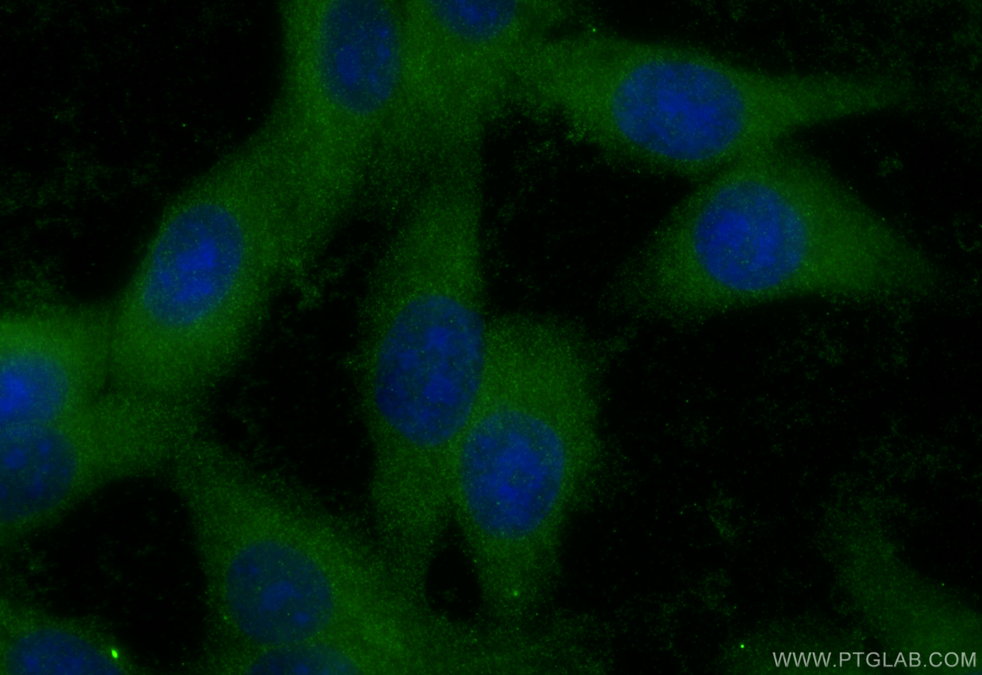 IF Staining of HepG2 using 10666-1-AP