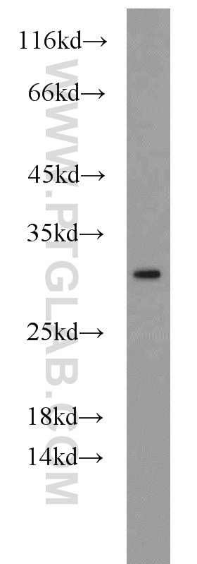 WB analysis of HepG2 using 10666-1-AP