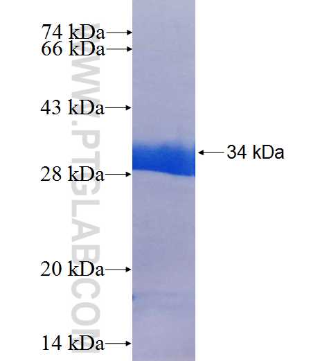 PMM2 fusion protein Ag25586 SDS-PAGE PMM2 fusion protein Ag25586 SDS-PAGE