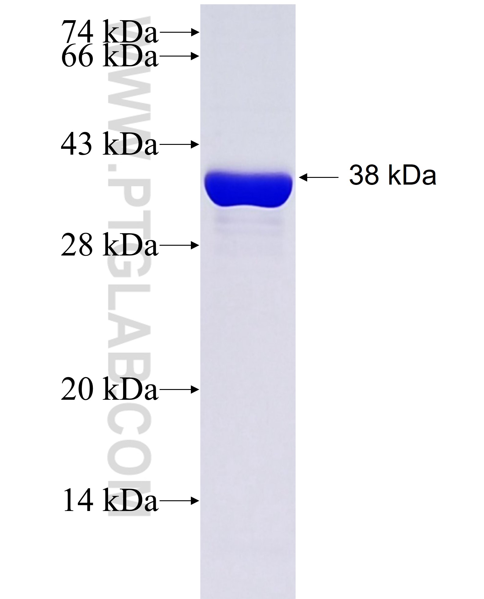 PMP2 fusion protein Ag3411 SDS-PAGE