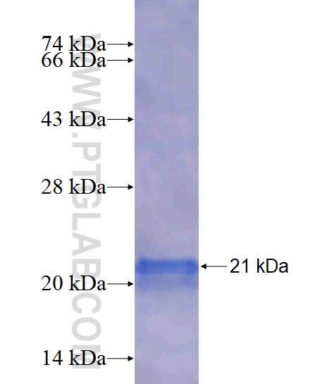 PMP2 fusion protein Ag4387 SDS-PAGE