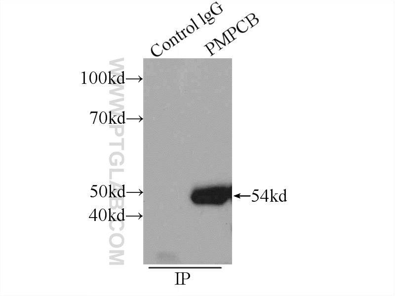 IP experiment of MCF-7 using 16064-1-AP