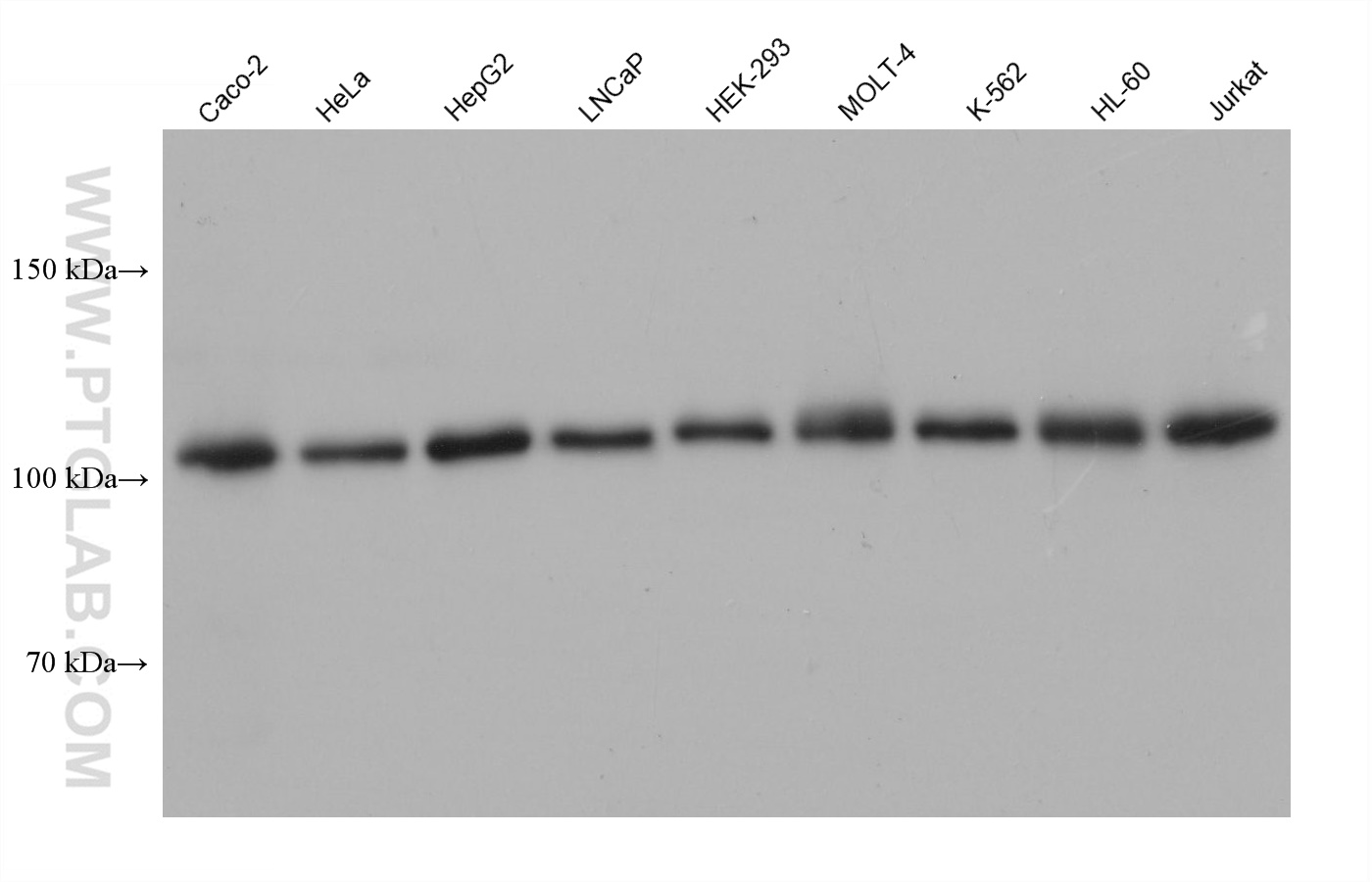 WB analysis using 68413-1-Ig