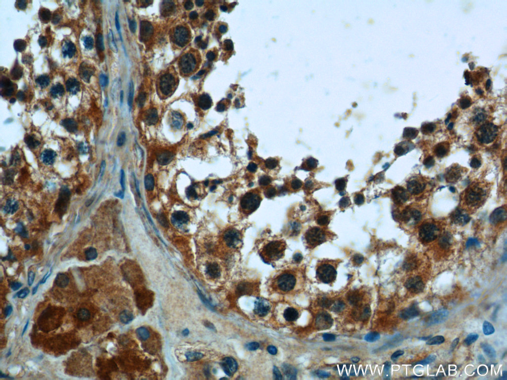 IHC staining of human testis using 25559-1-AP