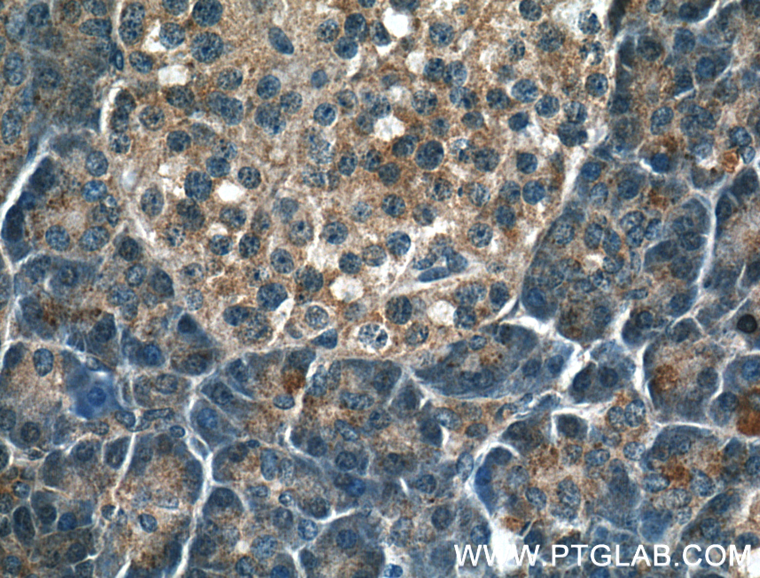 IHC staining of human pancreas using 26218-1-AP