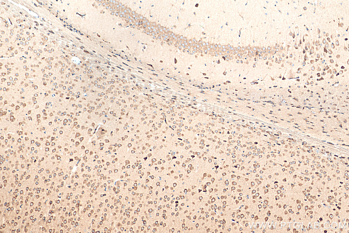 IHC staining of mouse brain using 13631-1-AP