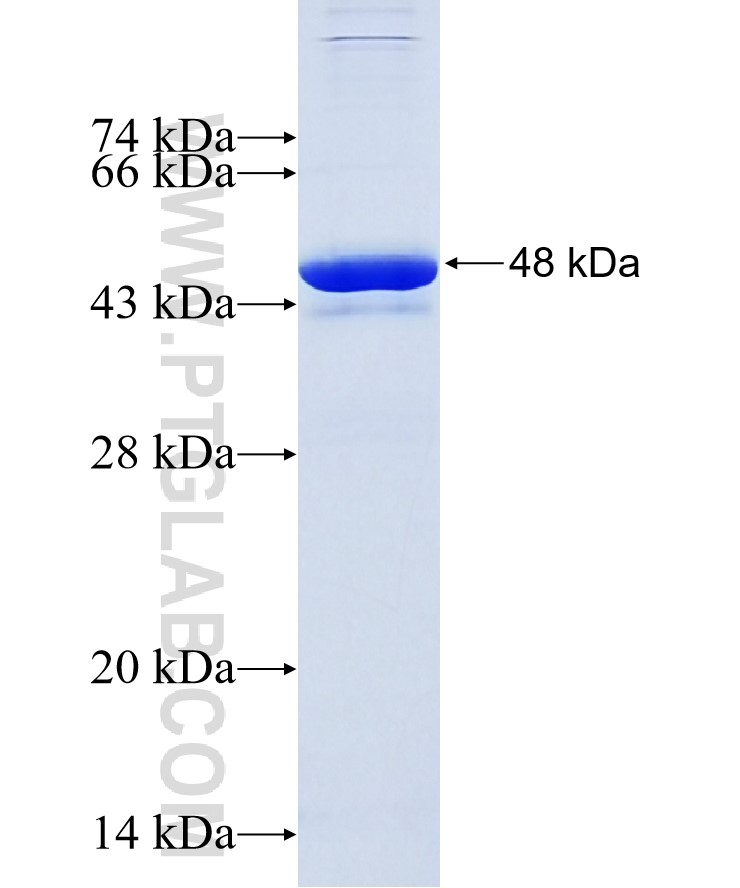 PNMA2 fusion protein Ag10304 SDS-PAGE