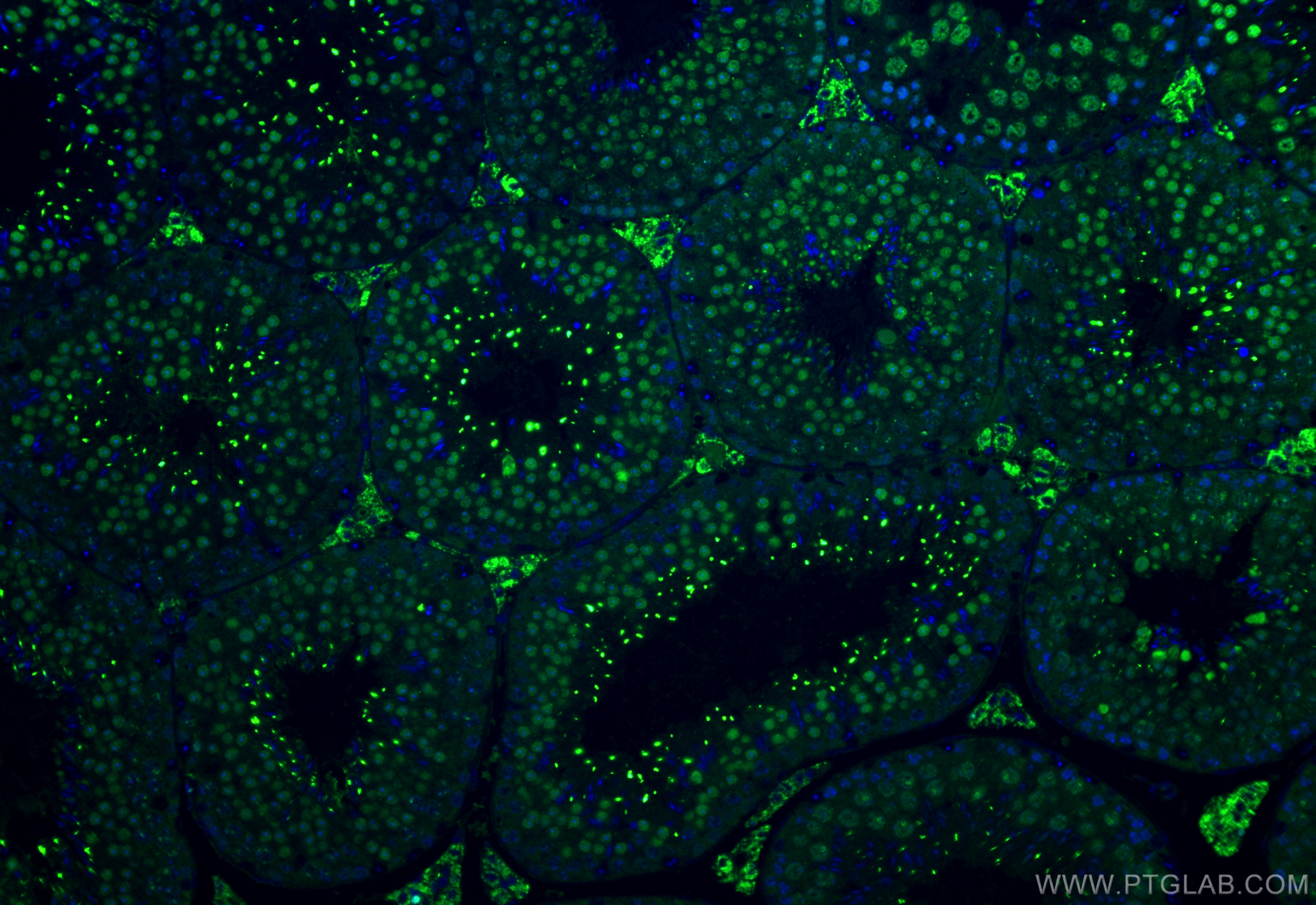 IF Staining of mouse testis using 21770-1-AP