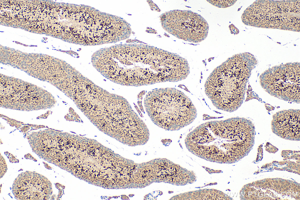 IHC staining of mouse testis using 21770-1-AP