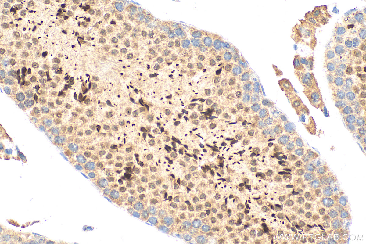 IHC staining of mouse testis using 21770-1-AP