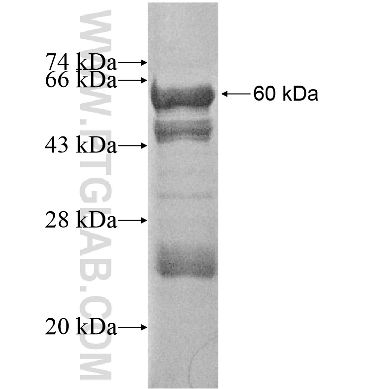 PNMA5 fusion protein Ag16414 SDS-PAGE