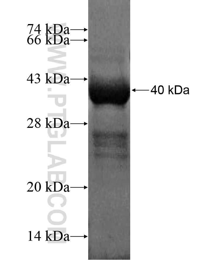 PNMA5 fusion protein Ag17222 SDS-PAGE