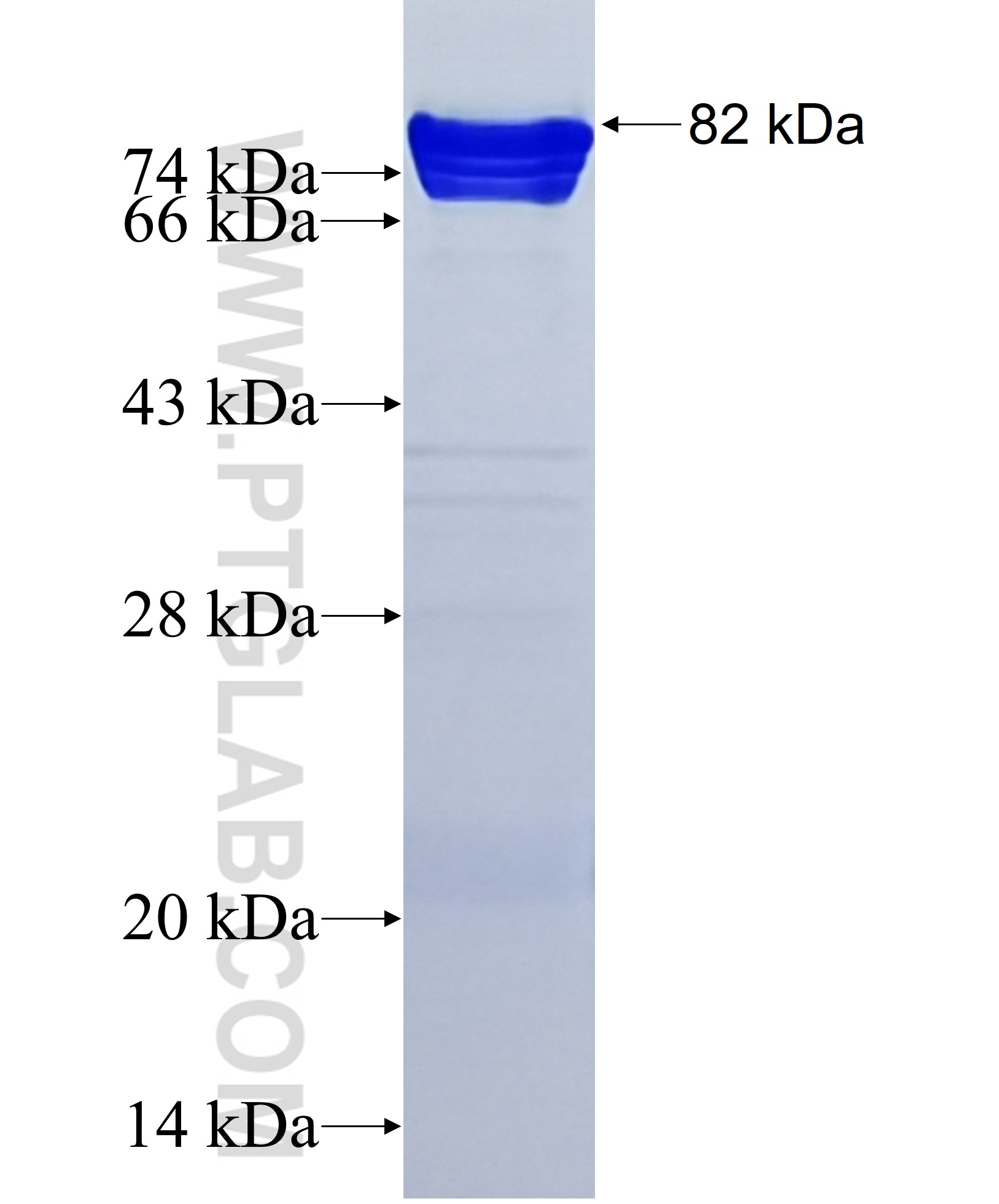 PNN fusion protein Ag38940 SDS-PAGE PNN fusion protein Ag38940 SDS-PAGE