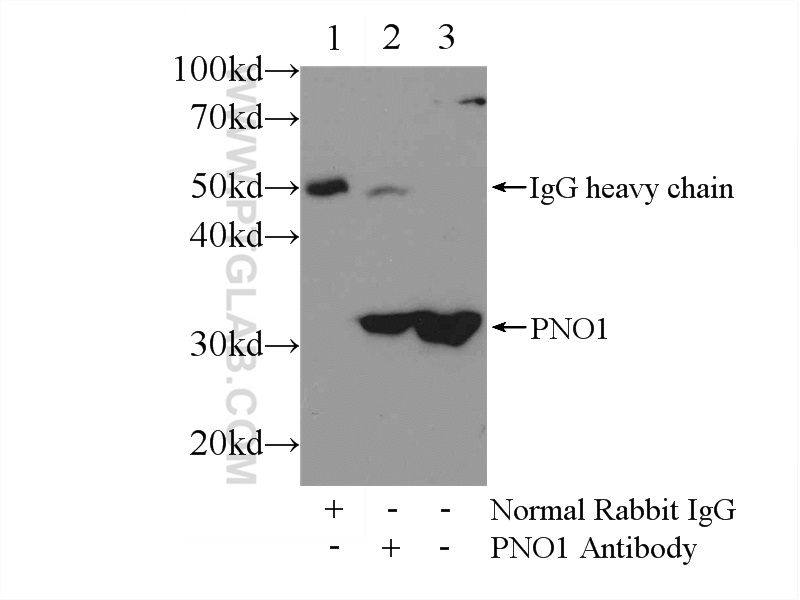 IP experiment of L02 using 21059-1-AP