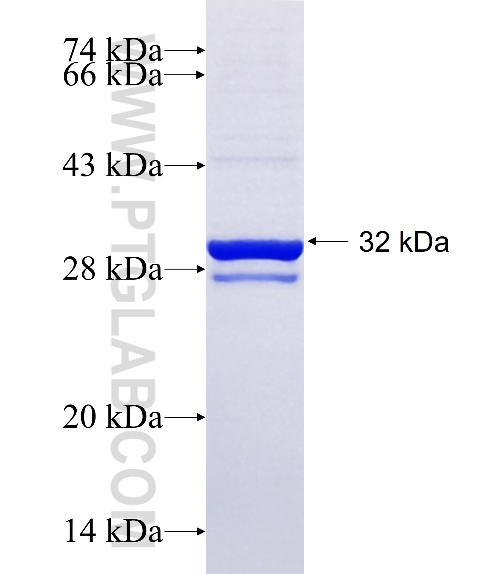 PNPLA1 fusion protein Ag34139 SDS-PAGE