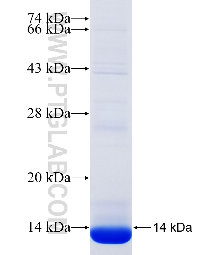PNPLA1 fusion protein Ag35467 SDS-PAGE