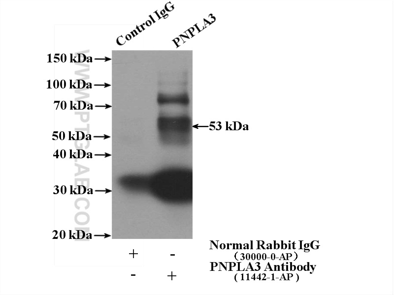 PNPLA3