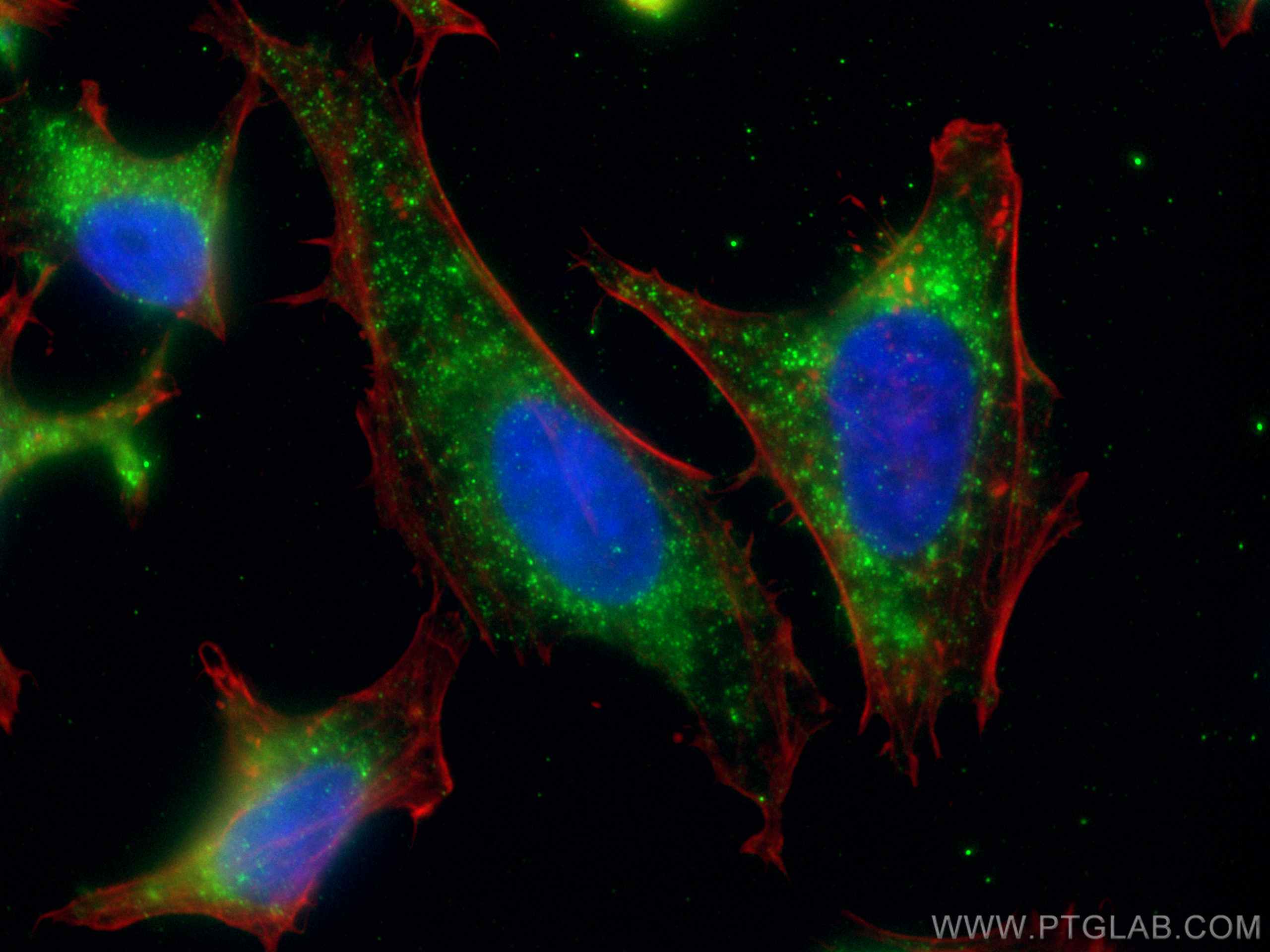 IF Staining of HeLa using 67369-1-Ig