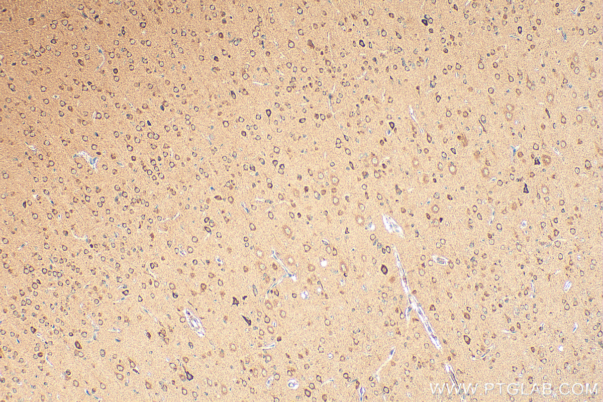 Immunohistochemical analysis of paraffin-embedded rat brain tissue slide using 14261-1-AP (PNPLA6 antibody) at dilution of 1:200 (under 10x lens). Heat mediated antigen retrieval with Tris-EDTA buffer (pH 9.0). IHC staining of rat brain using 14261-1-AP