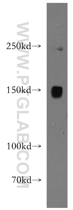 WB analysis of HEK-293 using 14261-1-AP