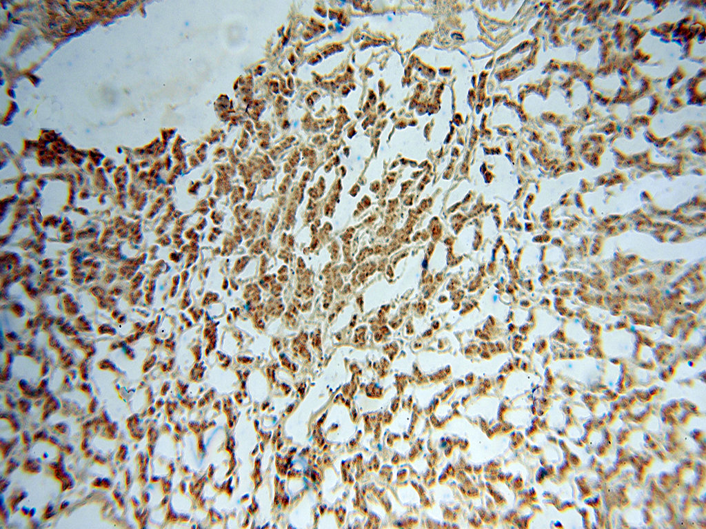 IHC staining of human liver using 15552-1-AP