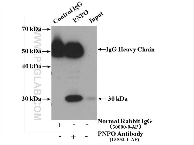 IP experiment of MCF-7 using 15552-1-AP