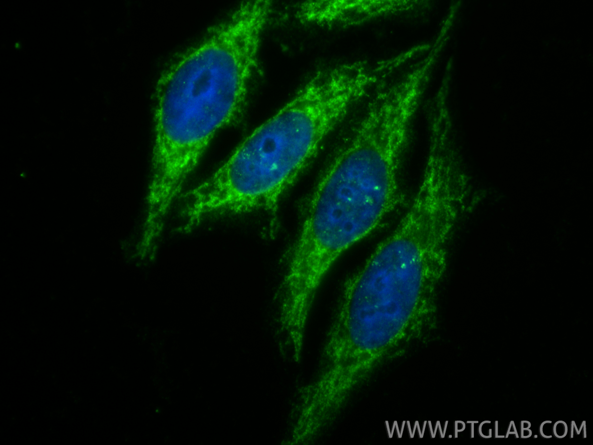 IF Staining of HepG2 using 14487-1-AP