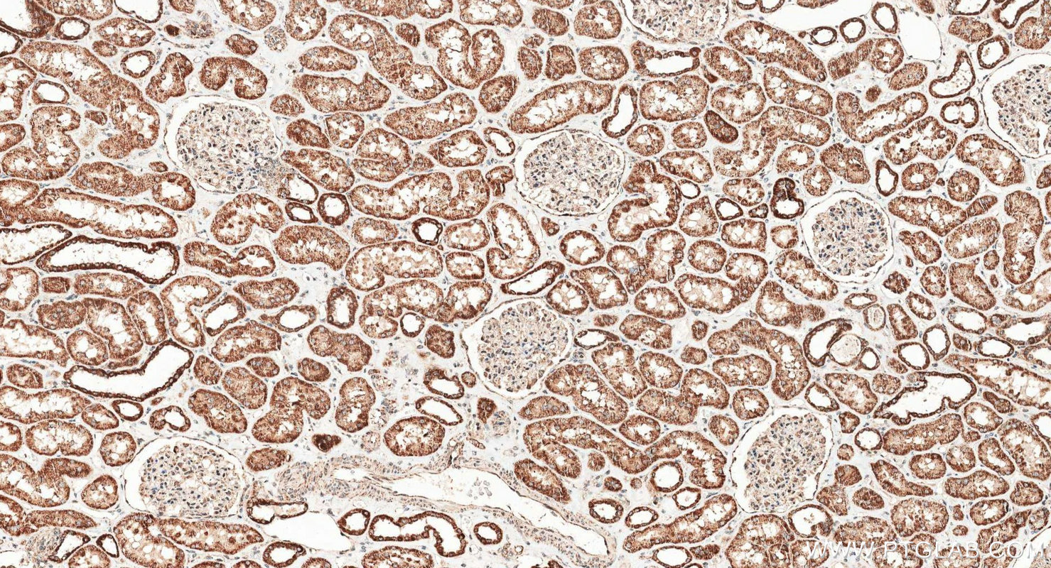 IHC staining of human kidney using 14487-1-AP IHC staining of human kidney using 14487-1-AP