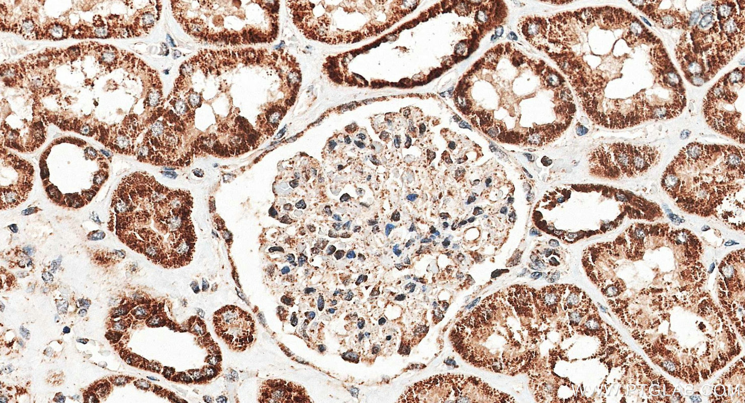 IHC staining of human kidney using 14487-1-AP IHC staining of human kidney using 14487-1-AP