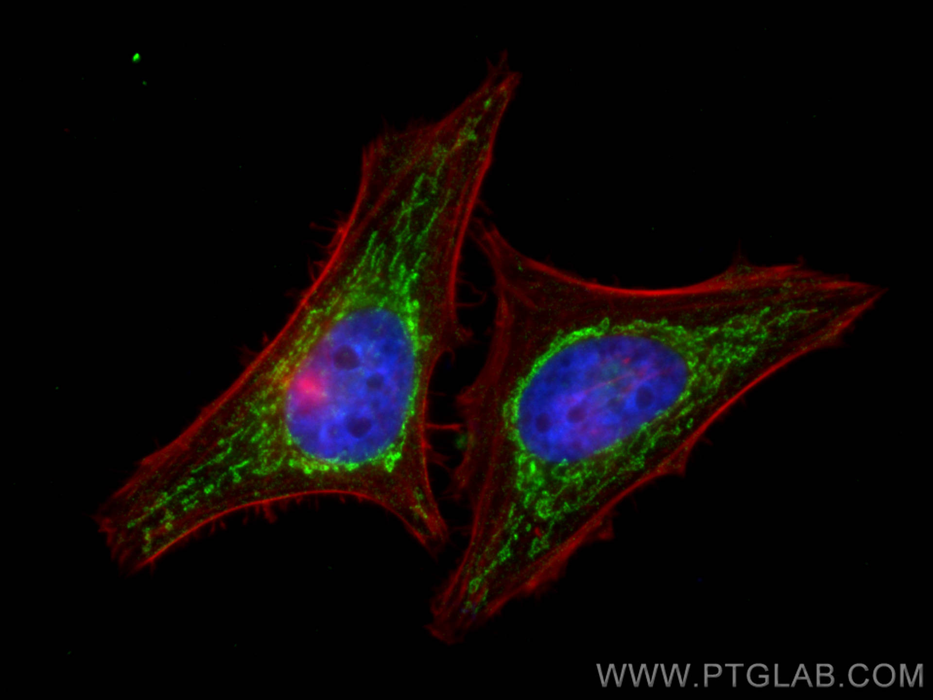 IF Staining of HeLa using 68309-1-Ig