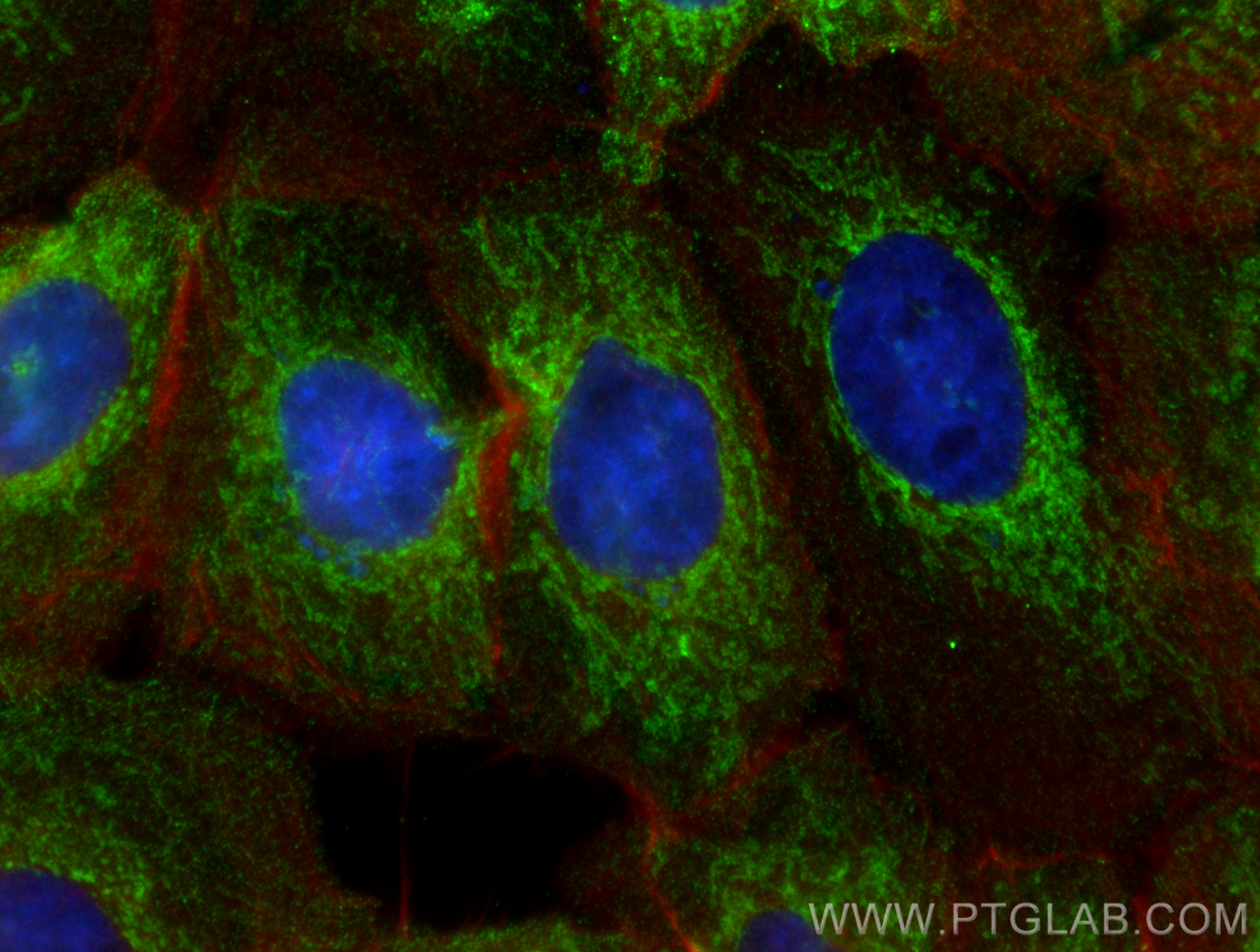 IF Staining of A431 using CL488-68309