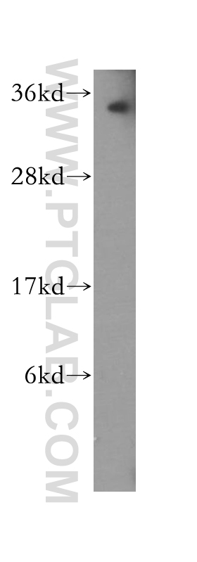 WB analysis of Raji using 51052-1-AP