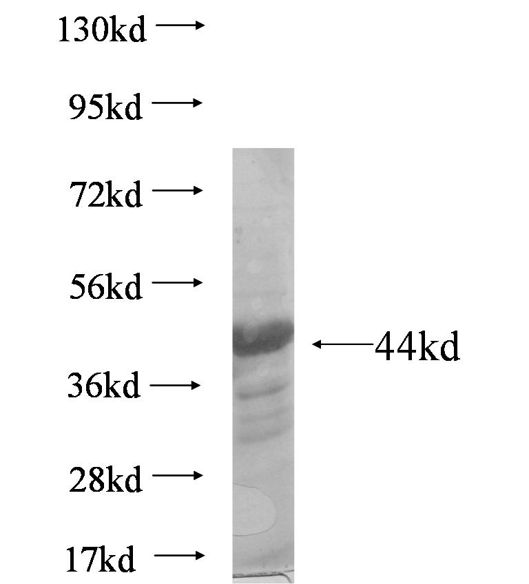 PODN fusion protein Ag6958 SDS-PAGE