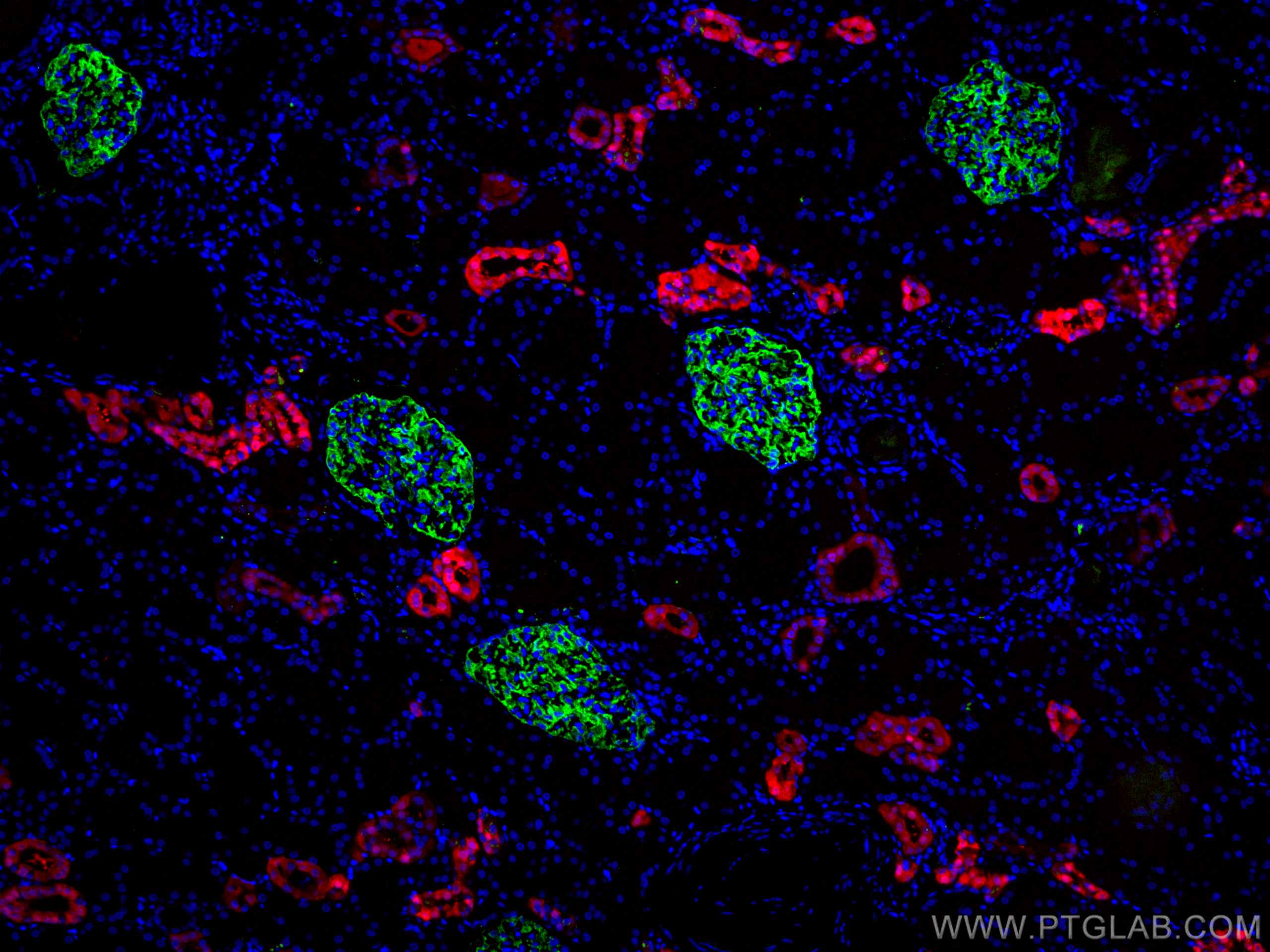 IF Staining of human kidney using 18150-1-AP