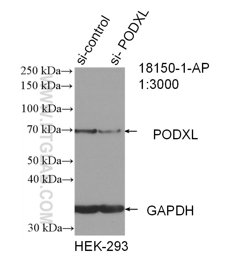 WB analysis of HEK-293 using 18150-1-AP