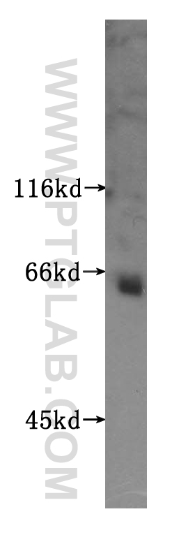 WB analysis of mouse pancreas using 16383-1-AP
