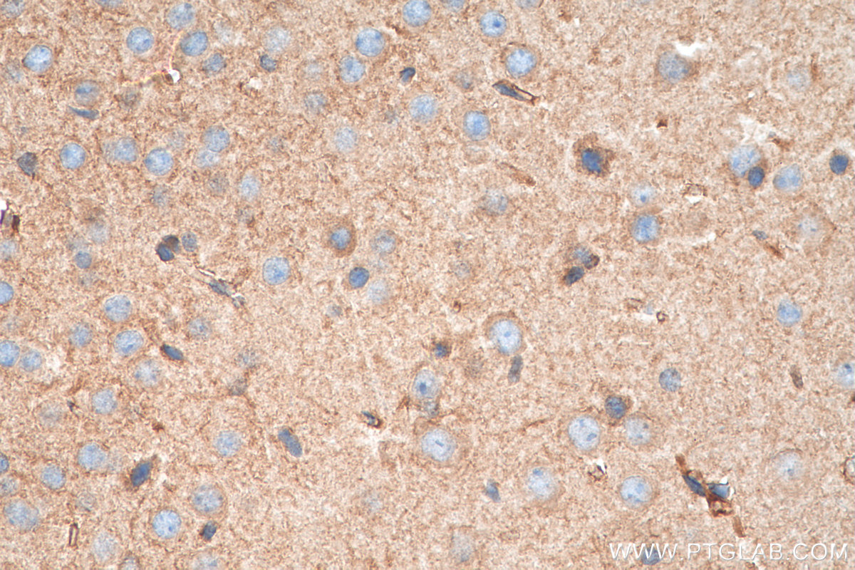 IHC staining of mouse brain using 17764-1-AP
