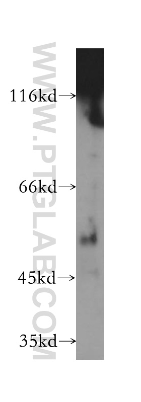 WB analysis of mouse brain using 17764-1-AP