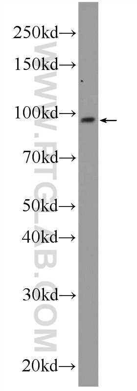 WB analysis of A549 using 24888-1-AP