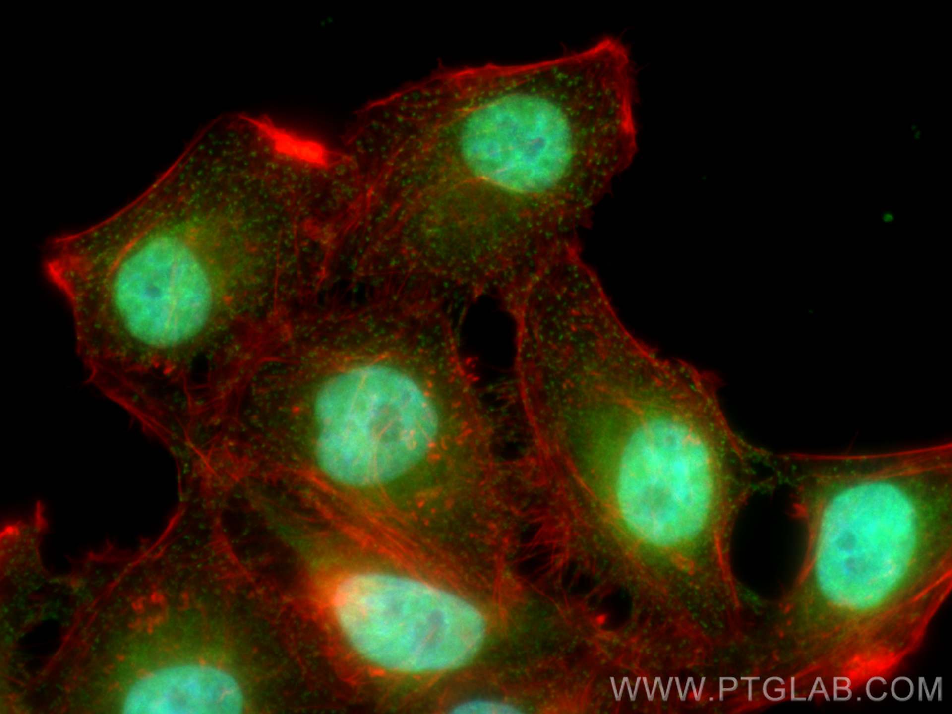 IF Staining of HepG2 using 30106-1-AP