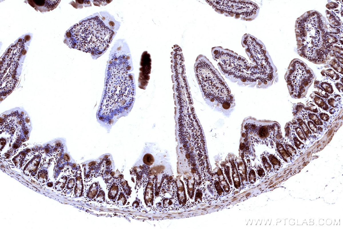 IHC staining of mouse small intestine using 31394-1-AP IHC staining of mouse small intestine using 31394-1-AP