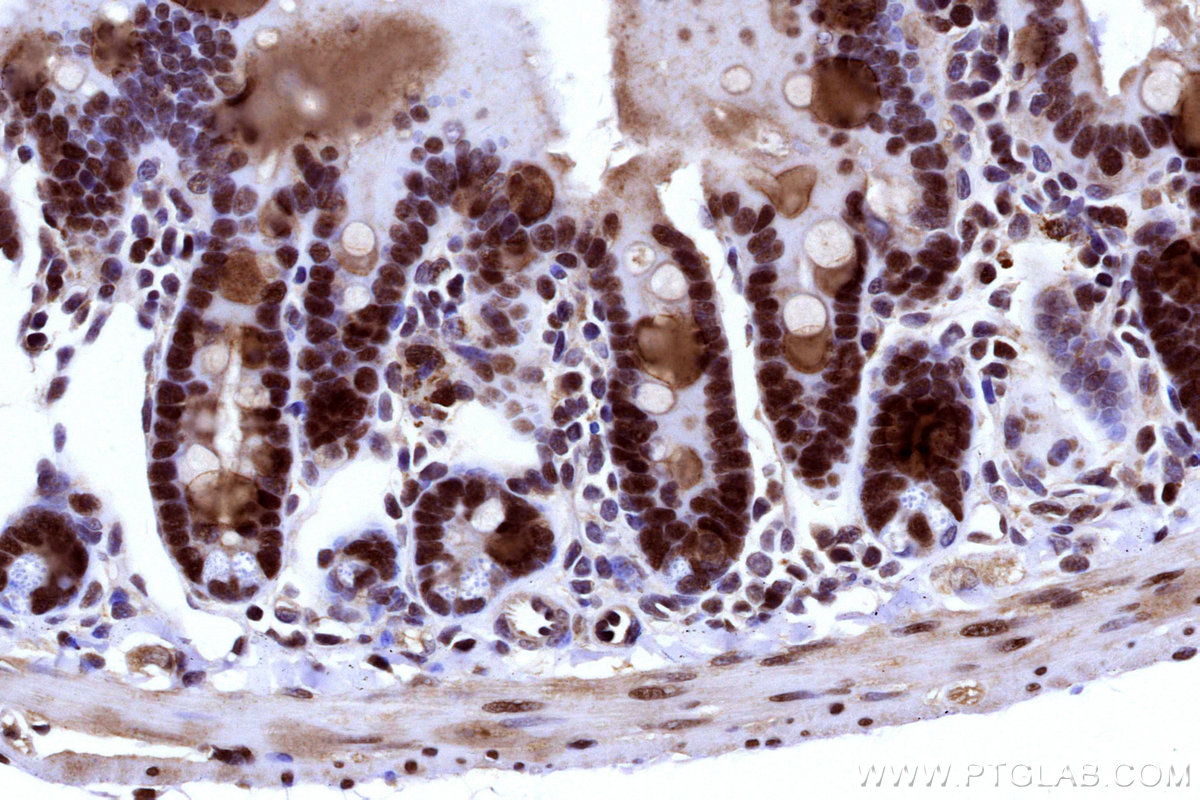 IHC staining of mouse small intestine using 31394-1-AP