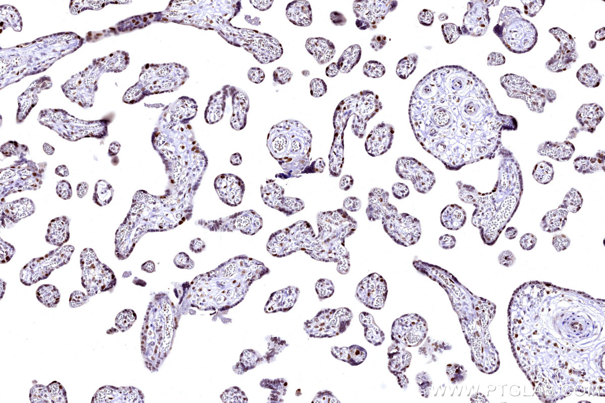 IHC staining of human placenta using 31394-1-AP IHC staining of human placenta using 31394-1-AP
