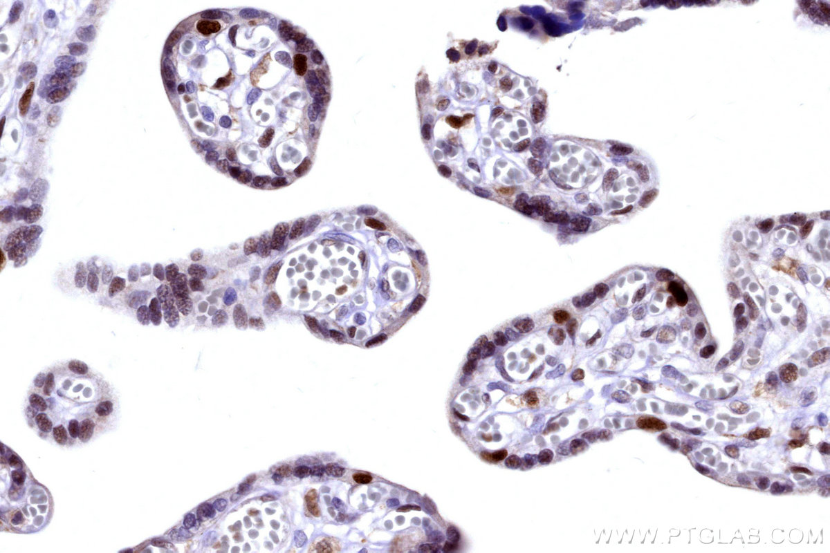 IHC staining of human placenta using 31394-1-AP