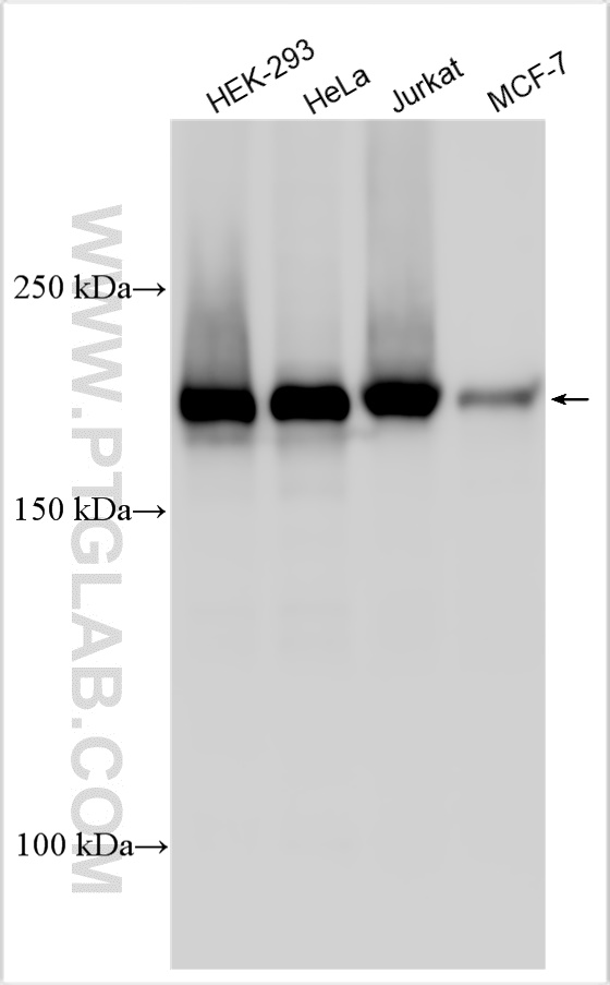 WB analysis using 31394-1-AP