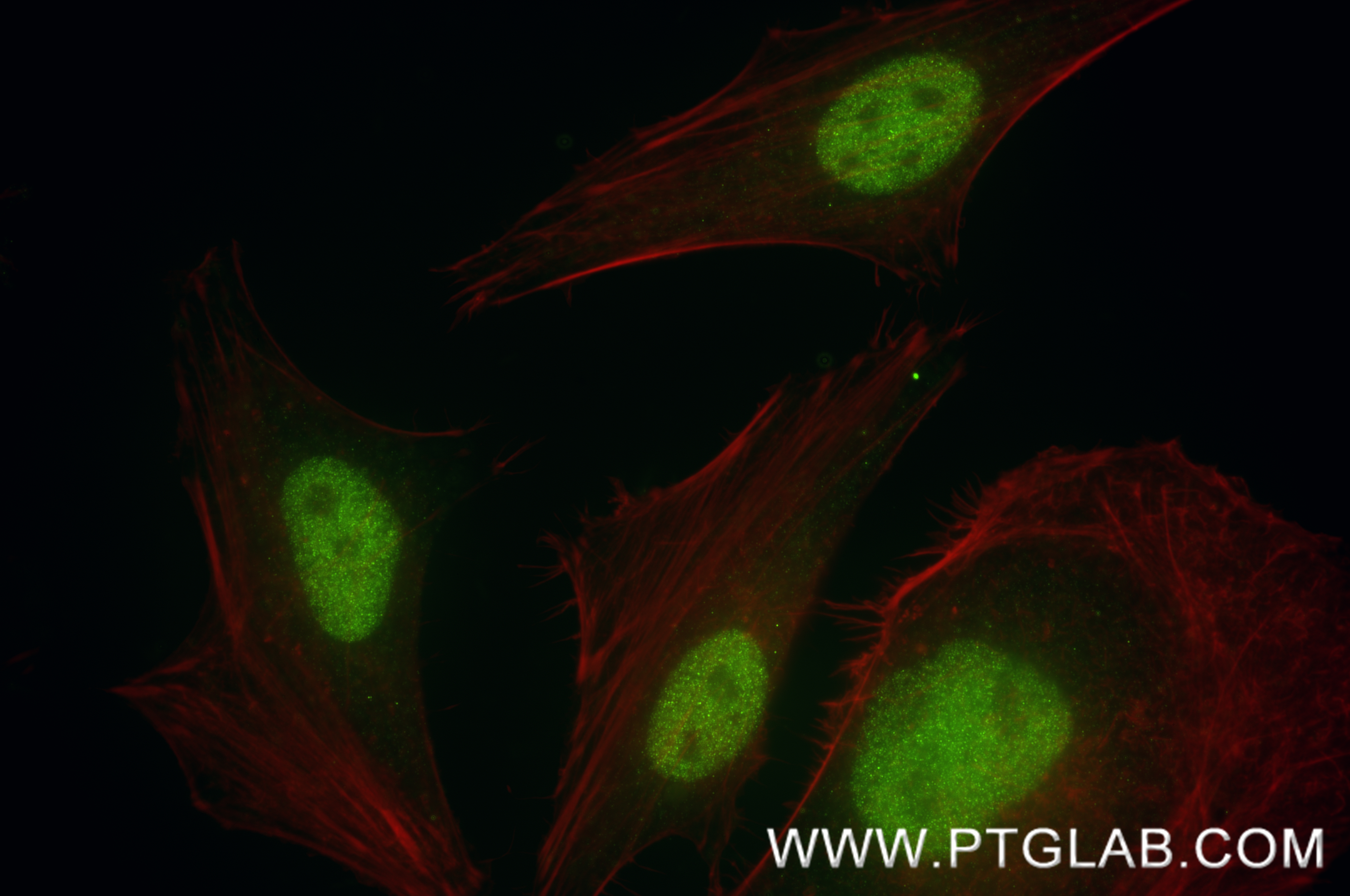 IF Staining of HeLa using 86856-1-RR (same clone as 86856-1-PBS)