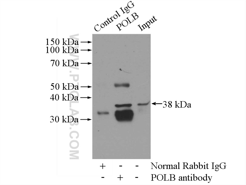 IP experiment of K-562 using 18003-1-AP