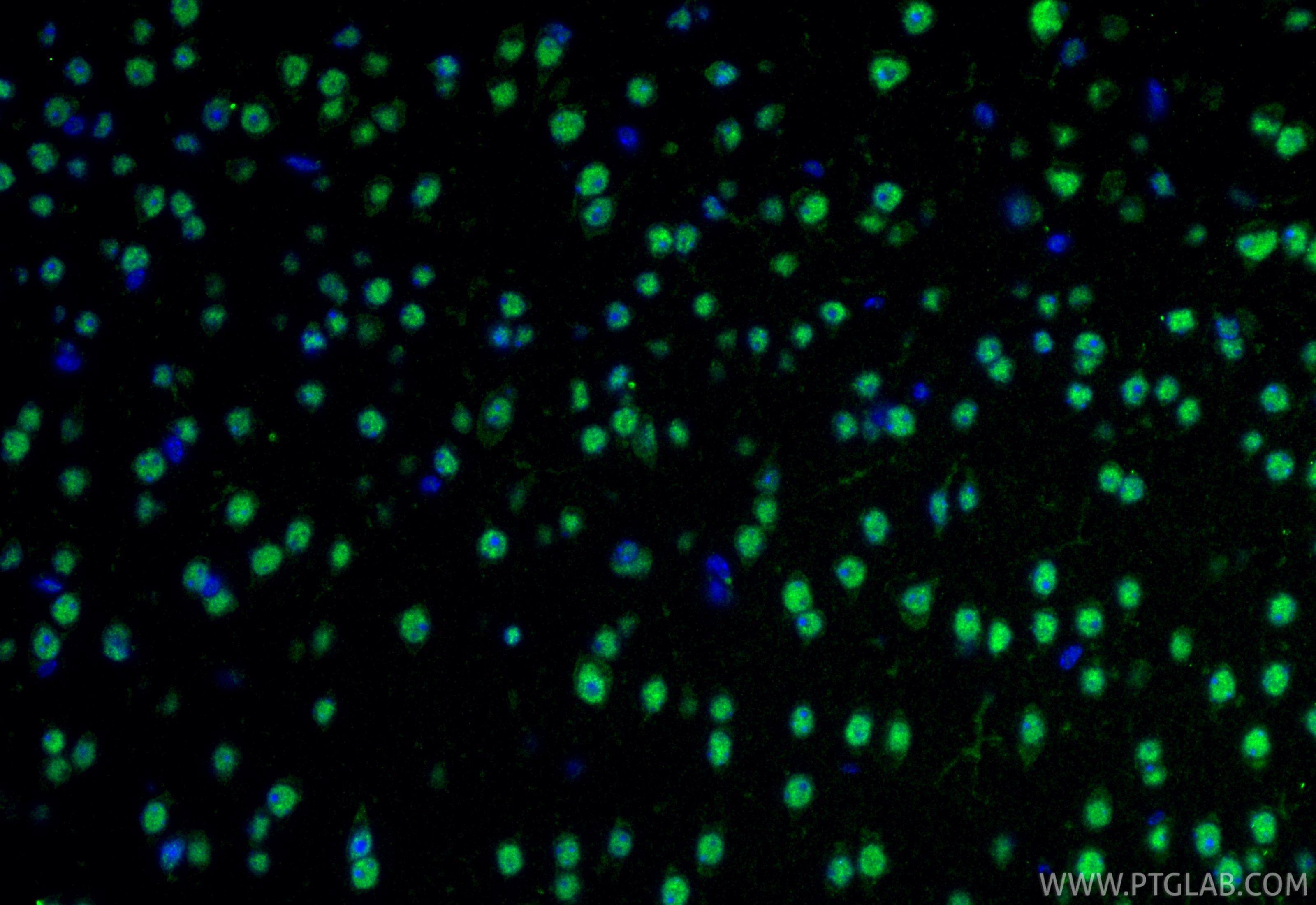 IF Staining of mouse brain using 86680-1-RR (same clone as 86680-1-PBS) IF Staining of mouse brain using 86680-1-RR (same clone as 86680-1-PBS)