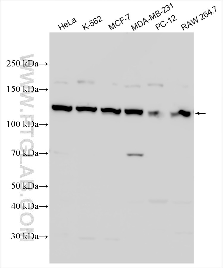 WB analysis using 15646-1-AP